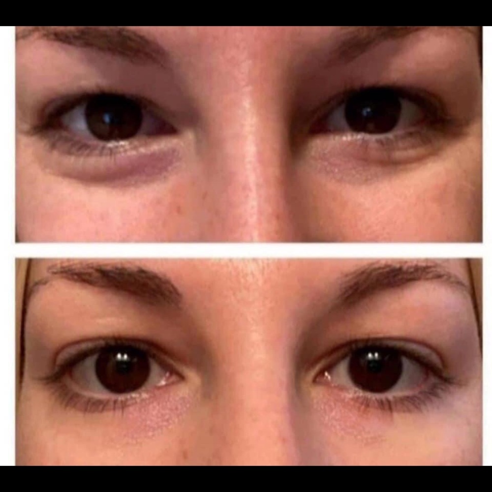 Eye cream